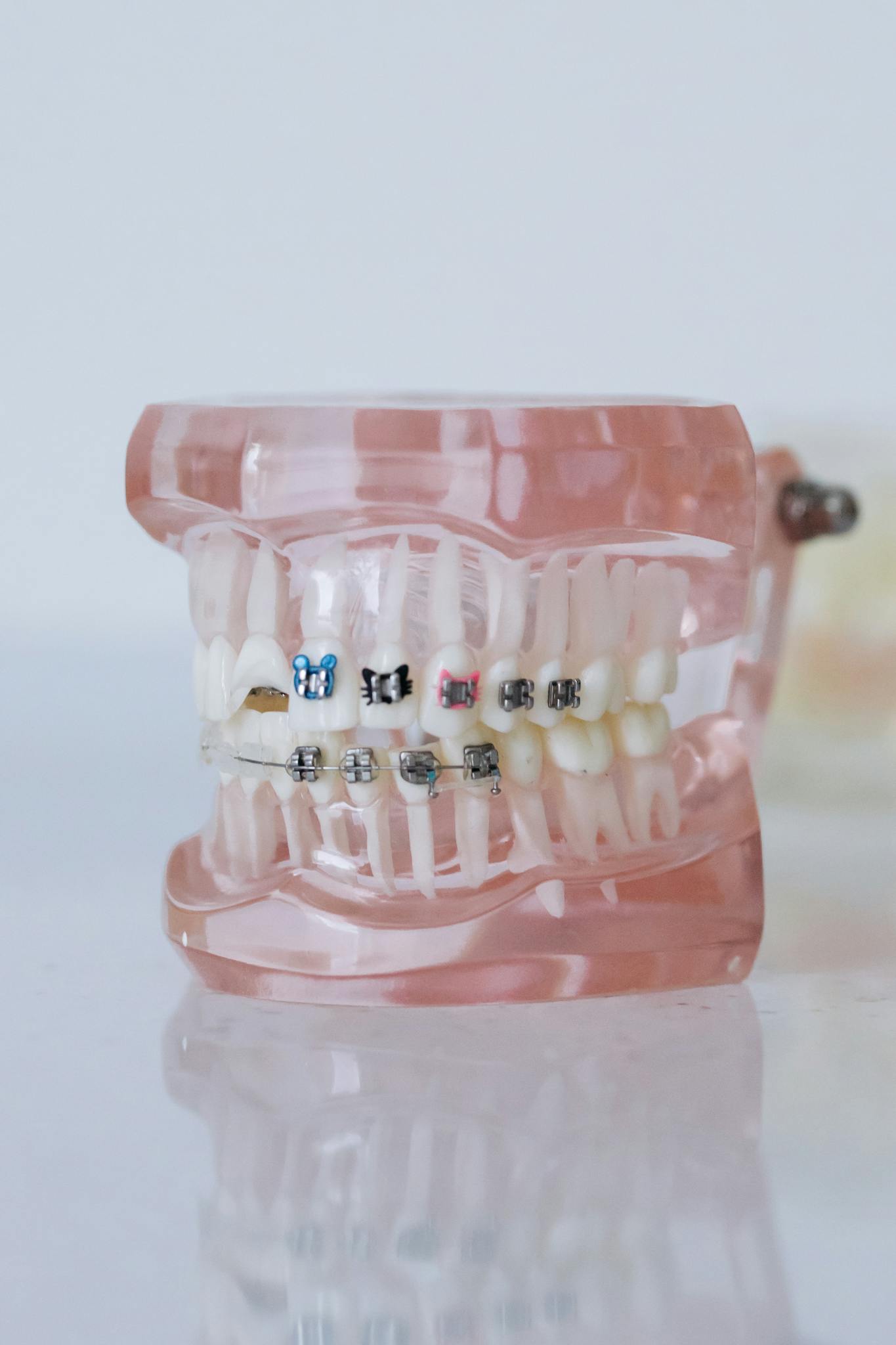 close up shot of dentures with braces Clear Aligner Treatments like Invisalign in Colorado: Achieve Your Dream Smile with Invisalign