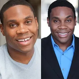 Invisalign before and after adult man