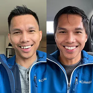 Invisalign before and after adult man