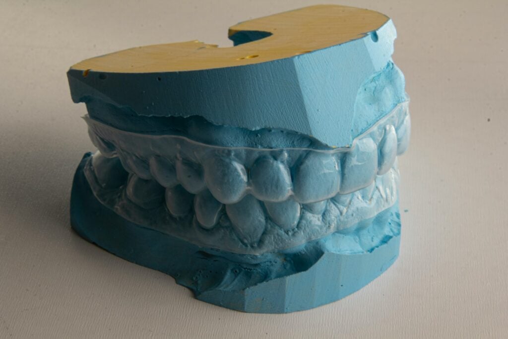 Is it Free? Invisalign Consultation Cost Explained 1 Invisalign Consultation Example Clear Aligners